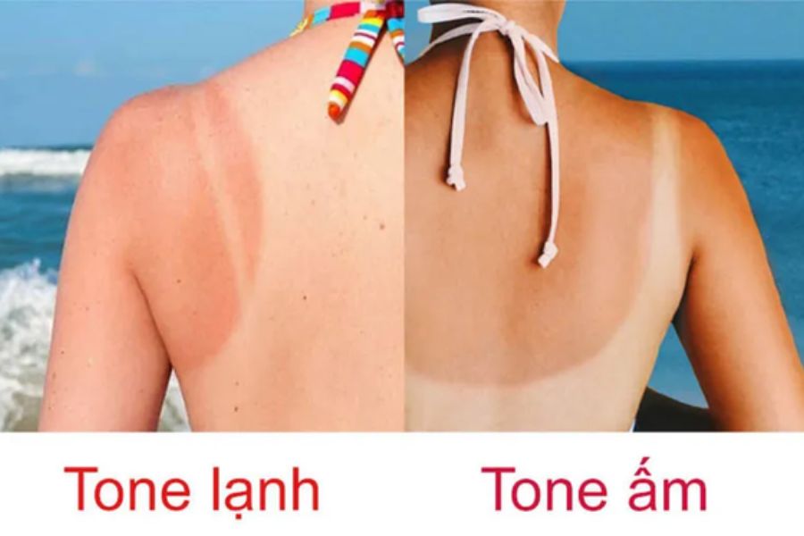 Xem phản ứng của da dưới nắng để xác định tone màu da